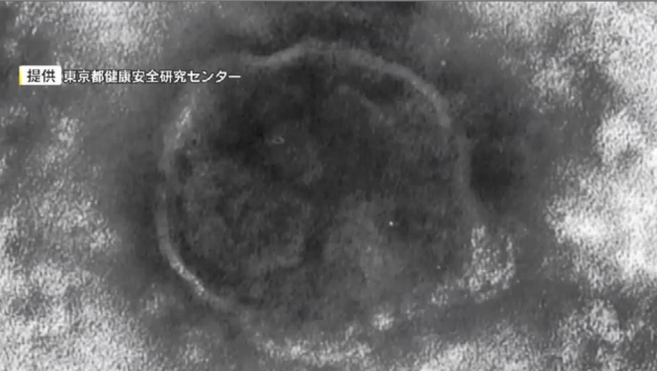 県内で感染相次ぐ「はしか」　県医師会がワクチン接種呼びかけ「成人でも母子手帳など確認して」接種率は目標の95%に届かず　福岡